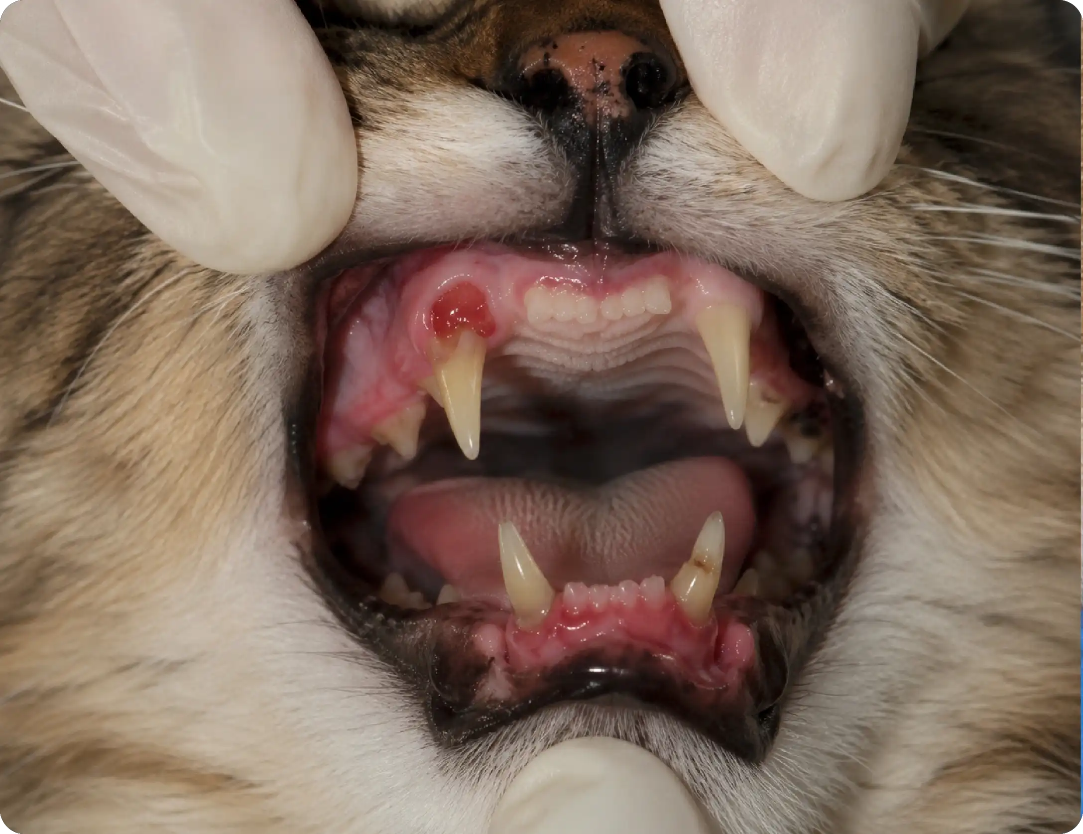 Tooth Resorption
